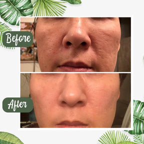 Diystar™ Masque Purifiant Anti-Bactérien à l'Extrait de Thé Vert