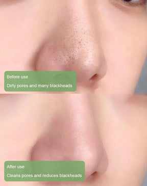 Diystar™ Masque Purifiant Anti-Bactérien à l'Extrait de Thé Vert