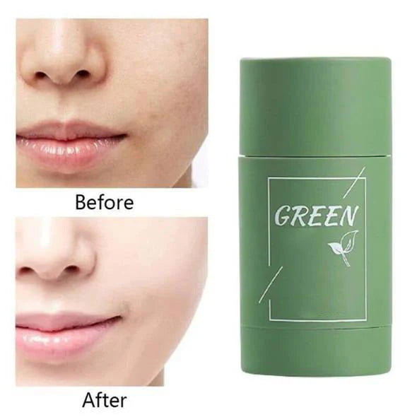 Diystar™ Masque Purifiant Anti-Bactérien à l'Extrait de Thé Vert